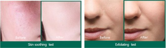 AHA-BHA-PHA 30 Days Miracle Serum