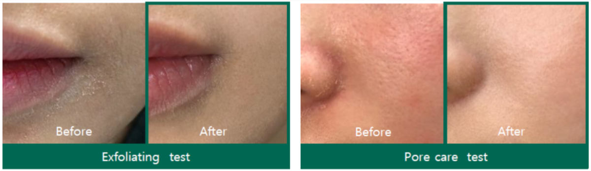 AHA-BHA-PHA 30 Days Miracle Toner